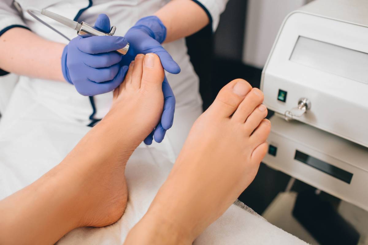 Featured image for Will Bleach Kill Nail Fungus?